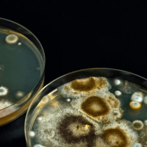 Picture of mold growth in a Petri dish